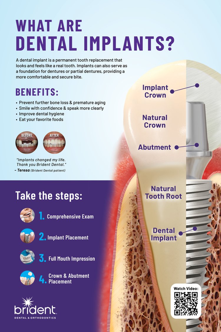 2208 BD DentalImplantClinical poster 24x36 QR final